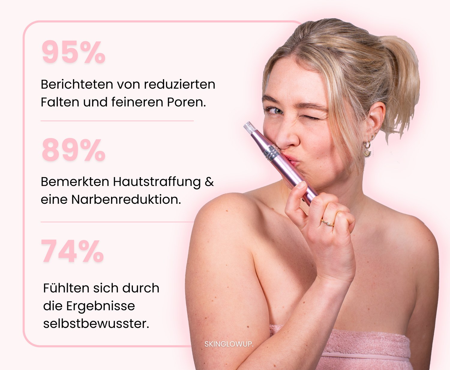 95% der Kunden berichten von reduzierten Falten und feineren Poren, 89% bemerkten eine Hautstraffung und Narbenreduktion, 74% fühlten sich nach dem Microneedling selbstbewusster.