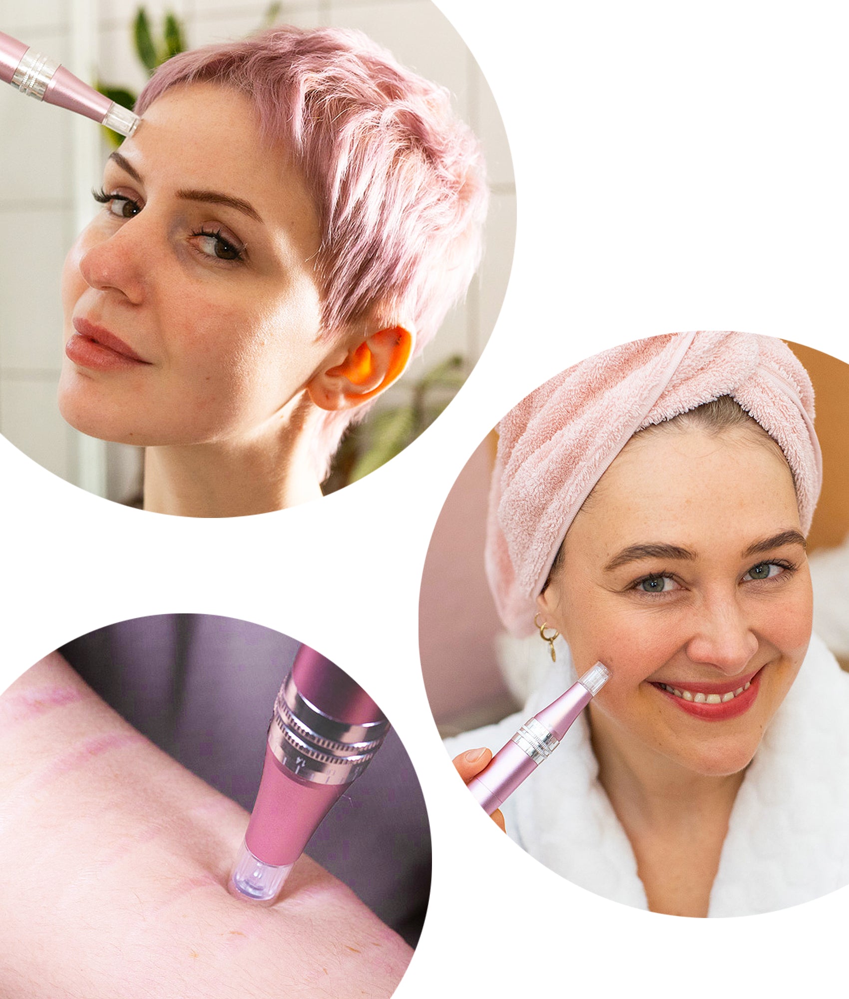 Das Banner zeigt die Microneedling Anwendung des Dermapens auf der Haut.