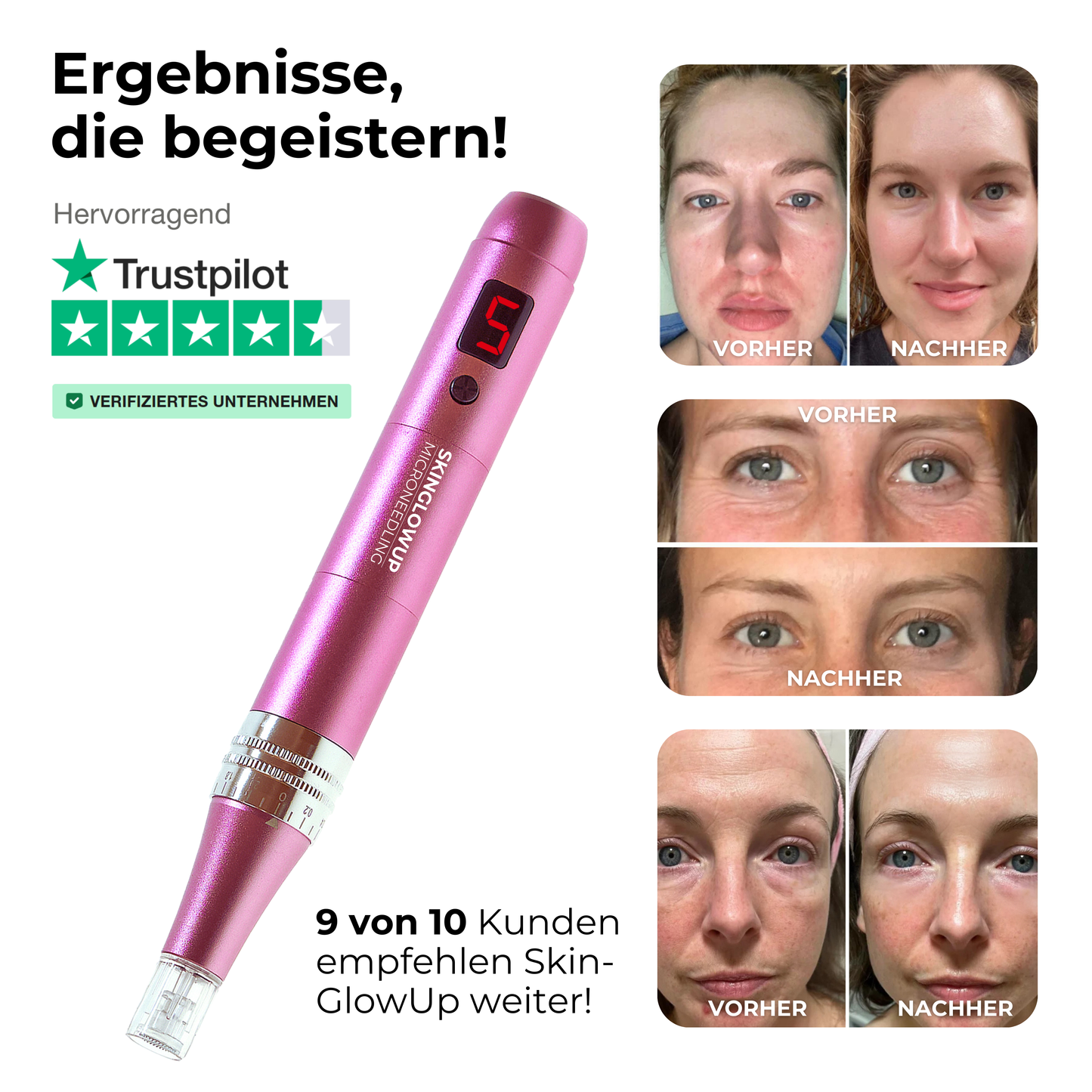 Anti-Aging Dermapen ᐅ Glatte Haut & weniger Falten zuhause