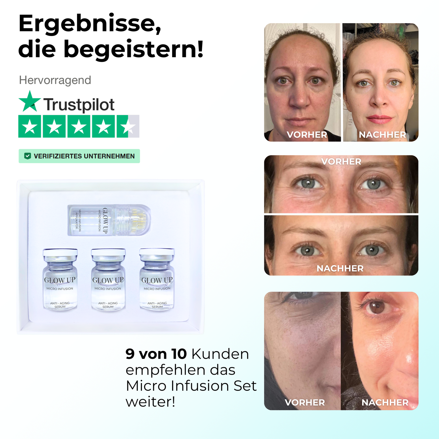 Micro Infusion Erfahrungen mit sichtbaren Vorher-Nachher Ergebnissen – deutlich glattere Haut, weniger Falten und ein ebenmäßigeres Hautbild nach 4 Wochen Anwendung zuhause