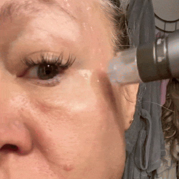 Micro Infusion Pen HydraGlow ᐅ Microneedling & Serum Infusion in einem Schritt