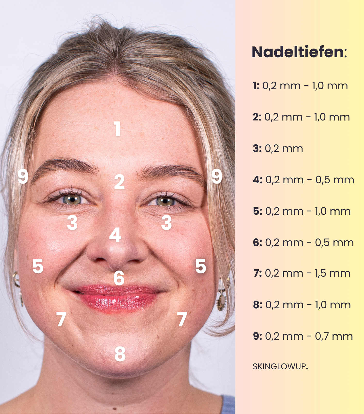 Microneedling Nadeltiefen für das Gesicht, die passende Nadeltiefe für jede Region deines Gesichts finden