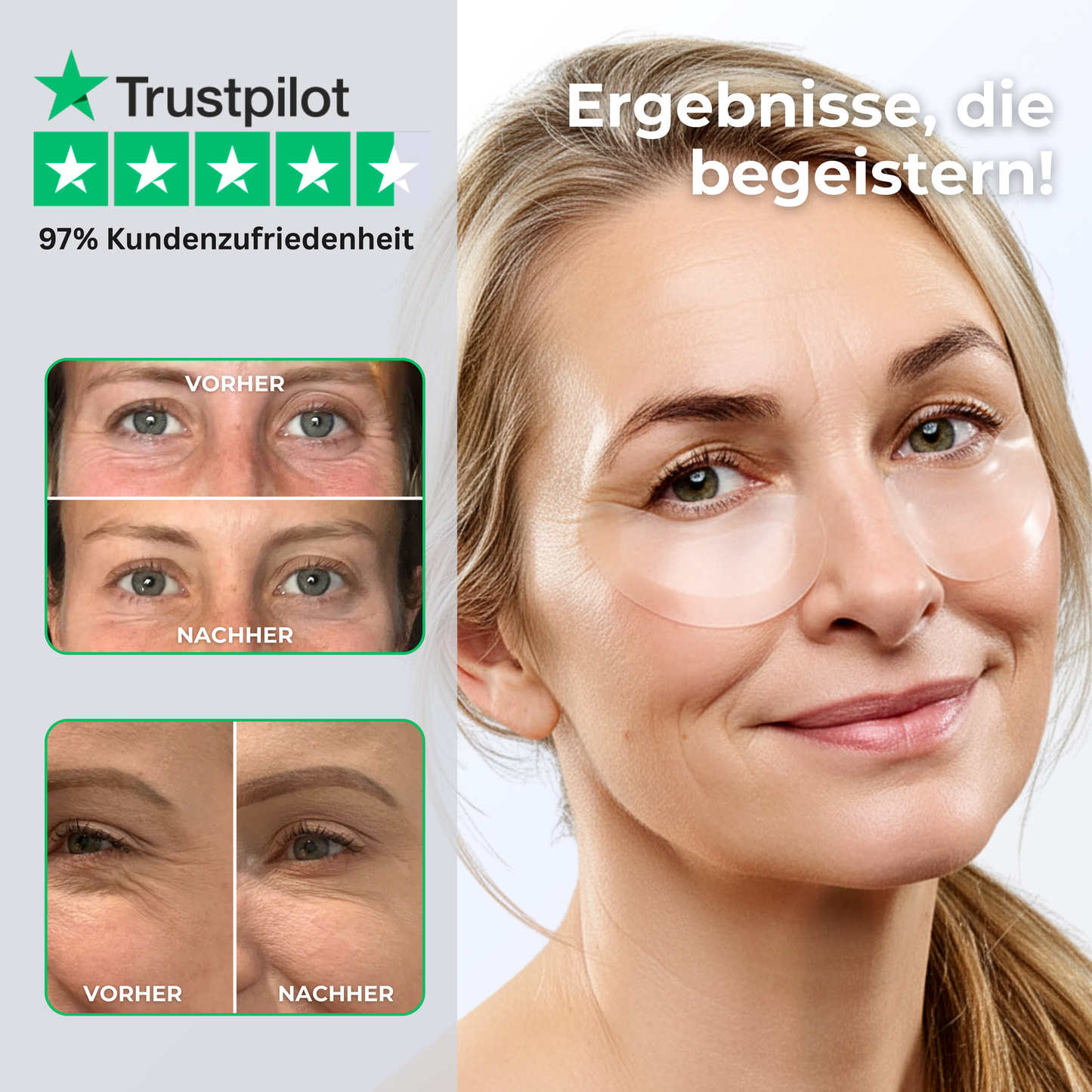Microneedle Infusion Eye Patches Vorher-Nachher Effekt gegen Augenringe, Tränensäcke und feine Falten