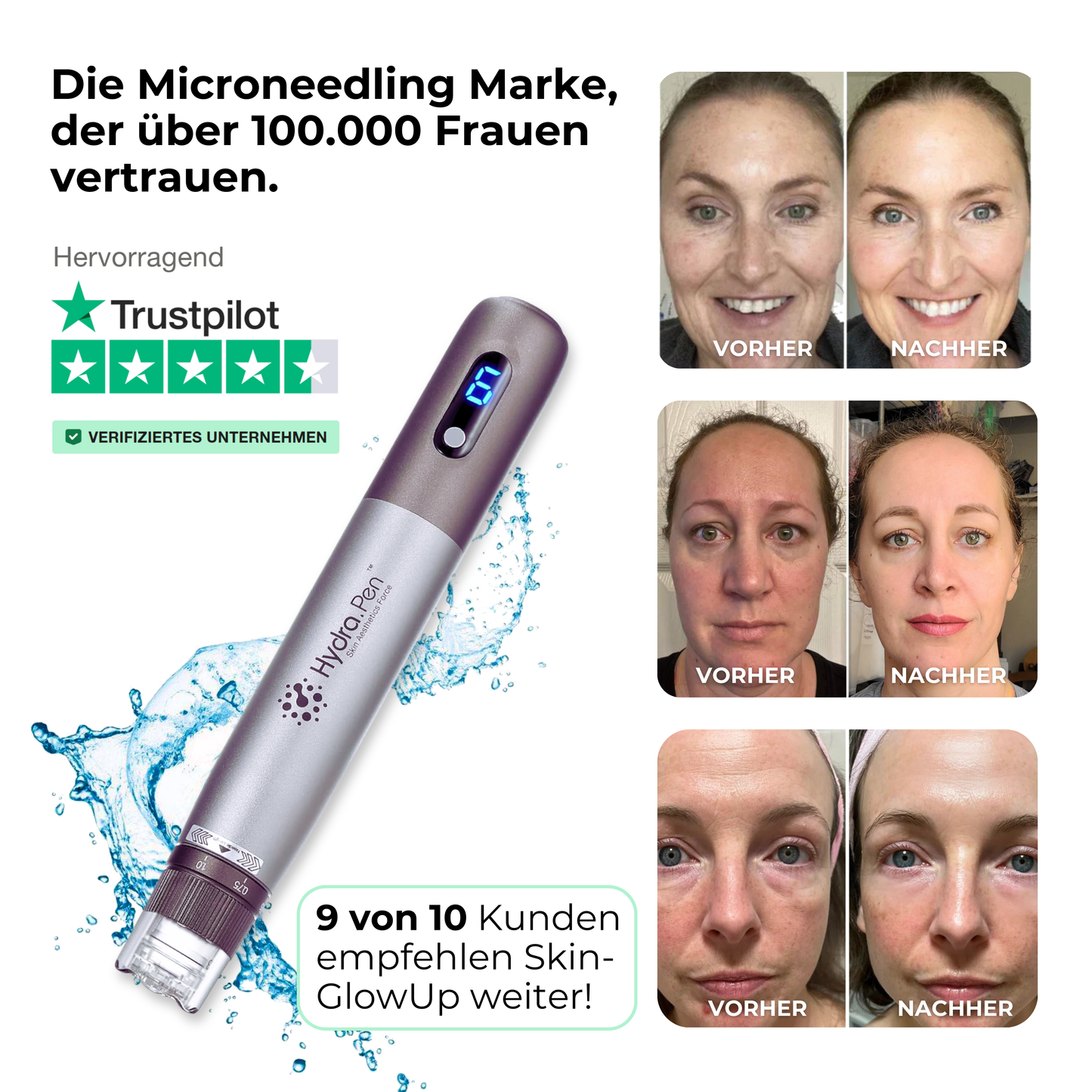 Micro Infusion Pen HydraGlow ᐅ Microneedling & Serum Infusion in einem Schritt