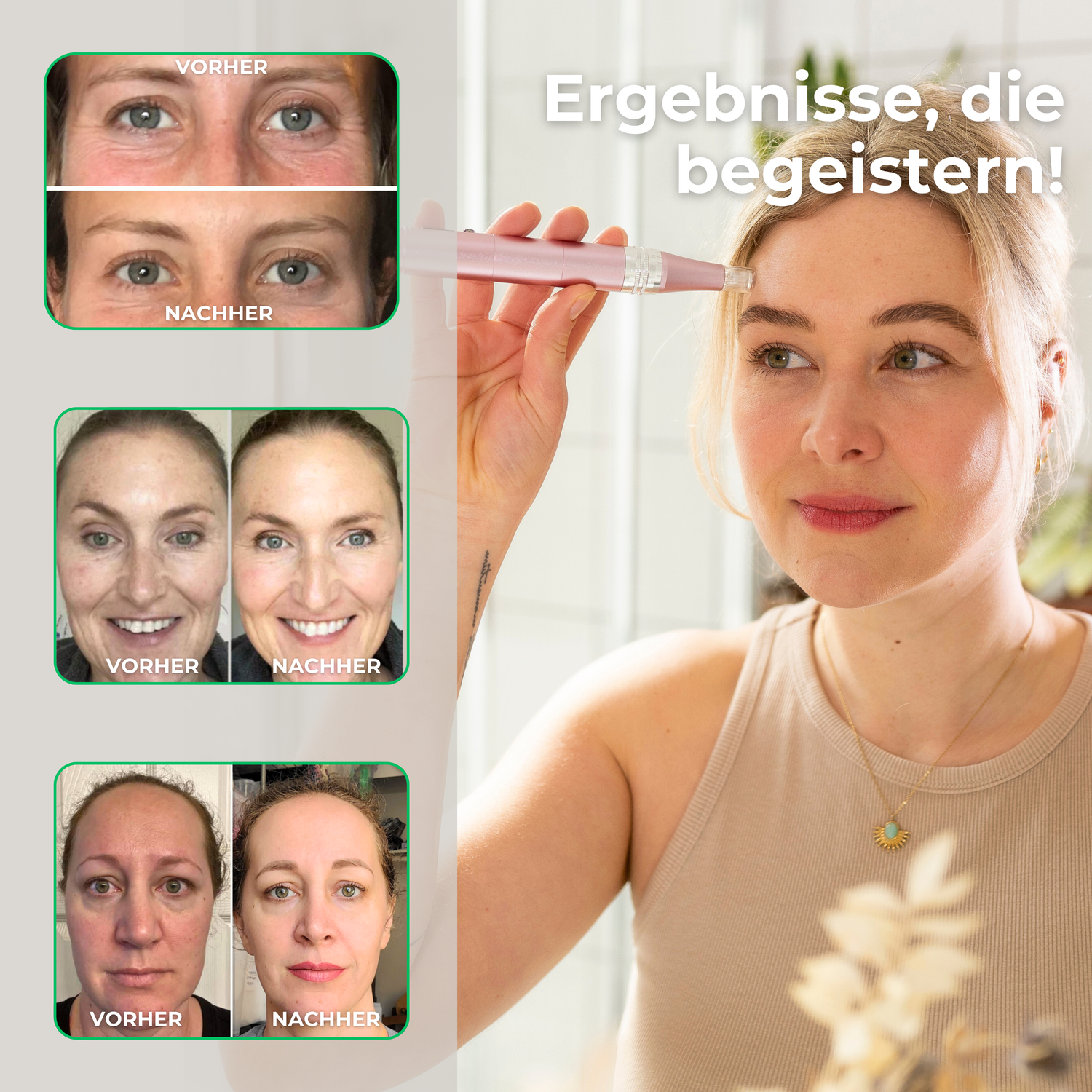Ein Banner dass 3 vorher nachher Bilder von Microneedling Anwendungen zeigt, auf der rechten Seite eine Frau im Badezimmer die einen Microneedling Pen auf der Stirn anwendet