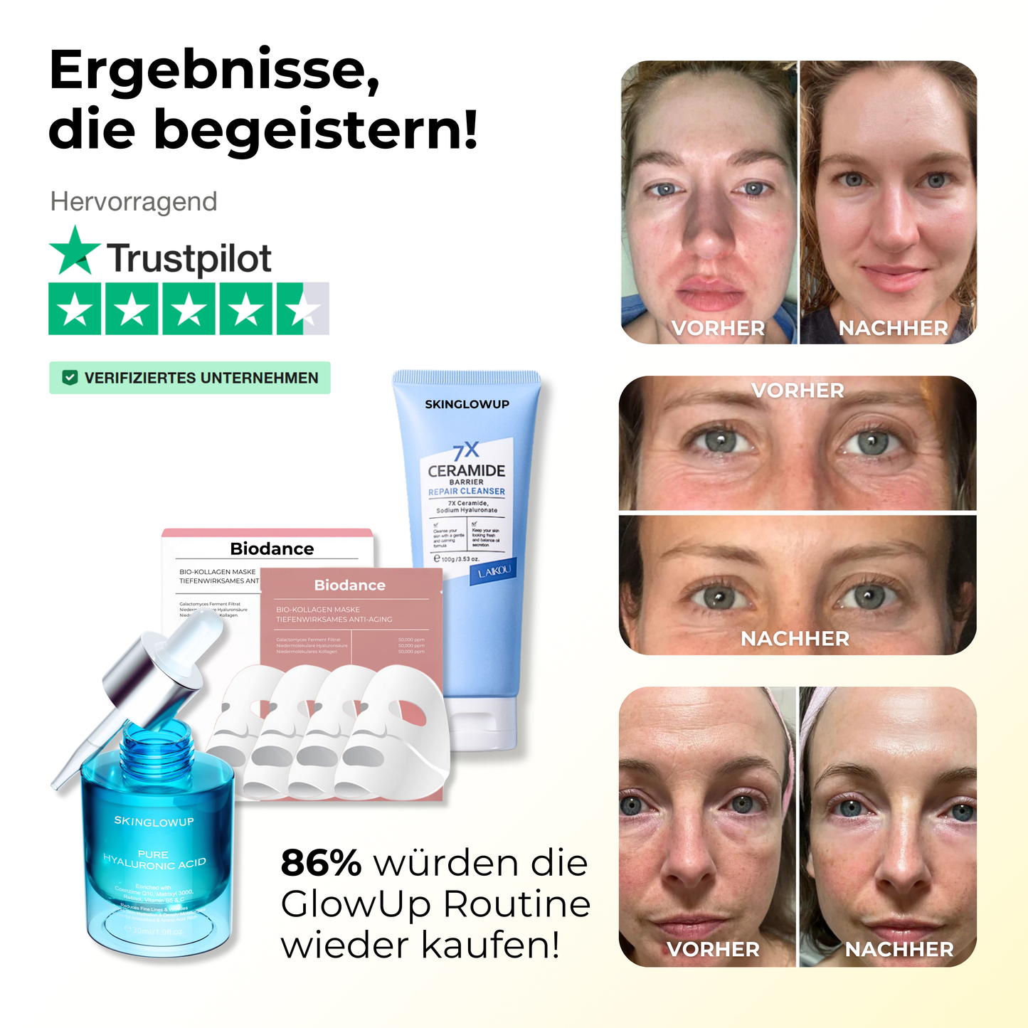 GlowUp Microneedling Komplettset ᐅ Vorbereiten, Verjüngen, Pflegen