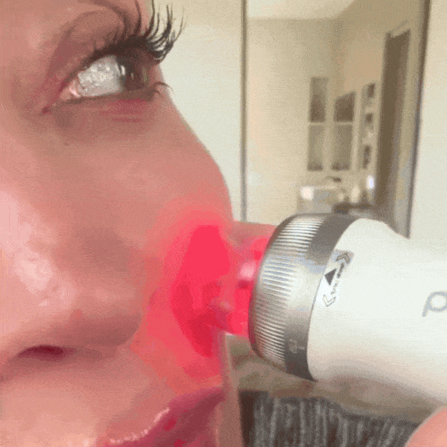 Dermapen Anti-Aging PRO 3in1 ᐅ Microneedling, EMS & LED für Studio Effekt zuhause
