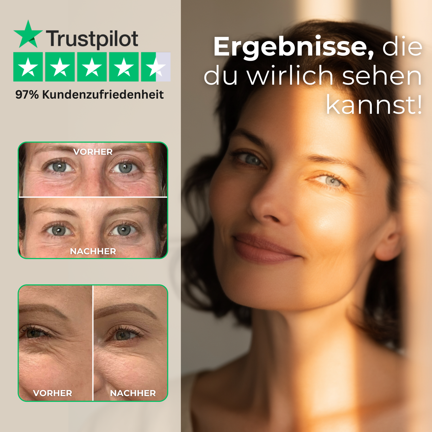 Vorher-Nachher-Ergebnisse bei Augenfalten und Schwellungen für einen wacheren Blick