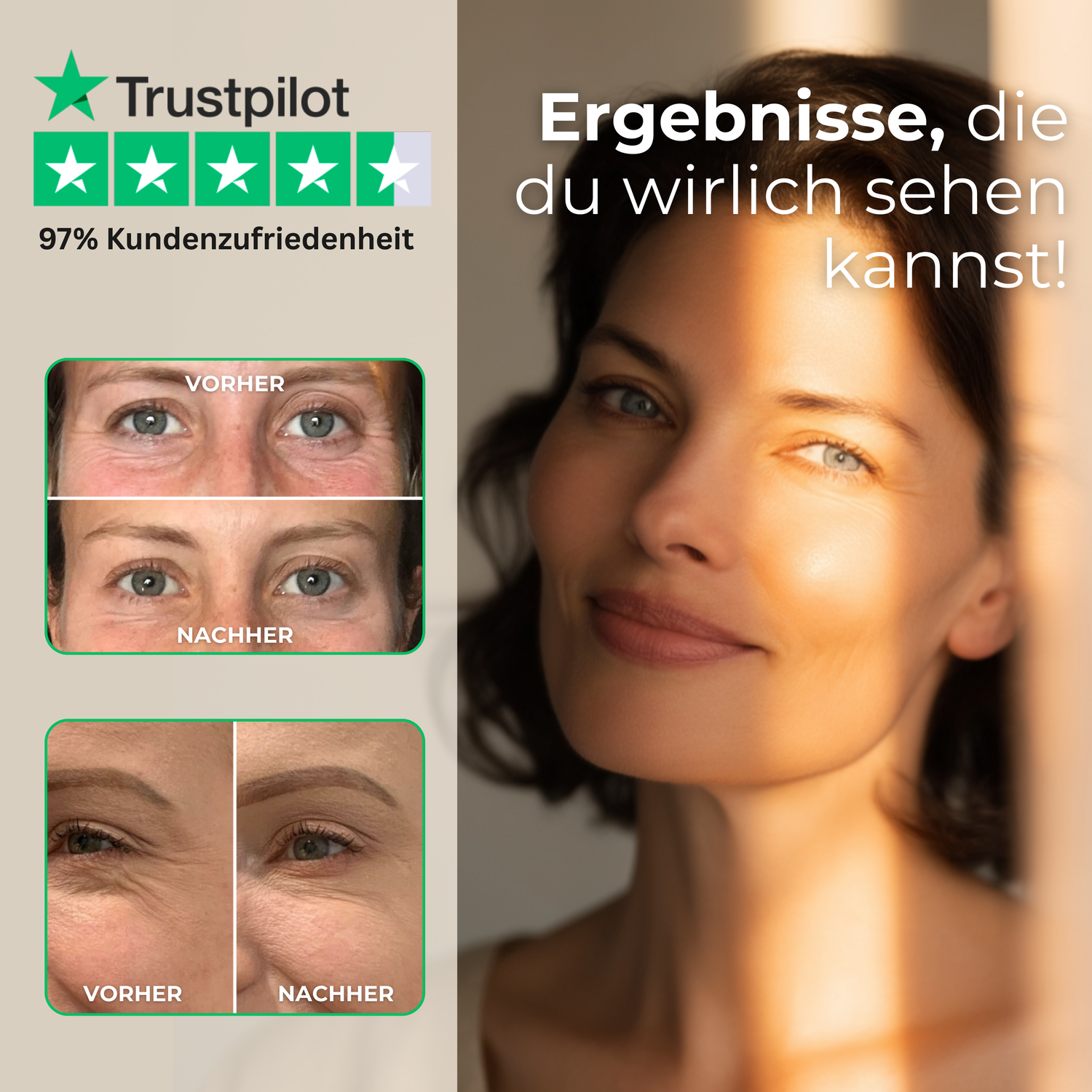 Vorher-Nachher-Ergebnisse bei Augenfalten und Schwellungen für einen wacheren Blick