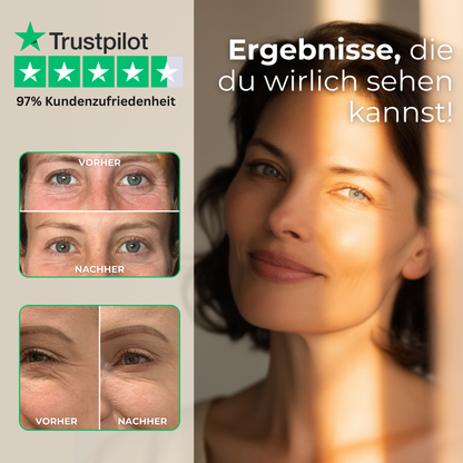 Vorher-Nachher-Ergebnisse bei Augenfalten und Schwellungen für einen wacheren Blick
