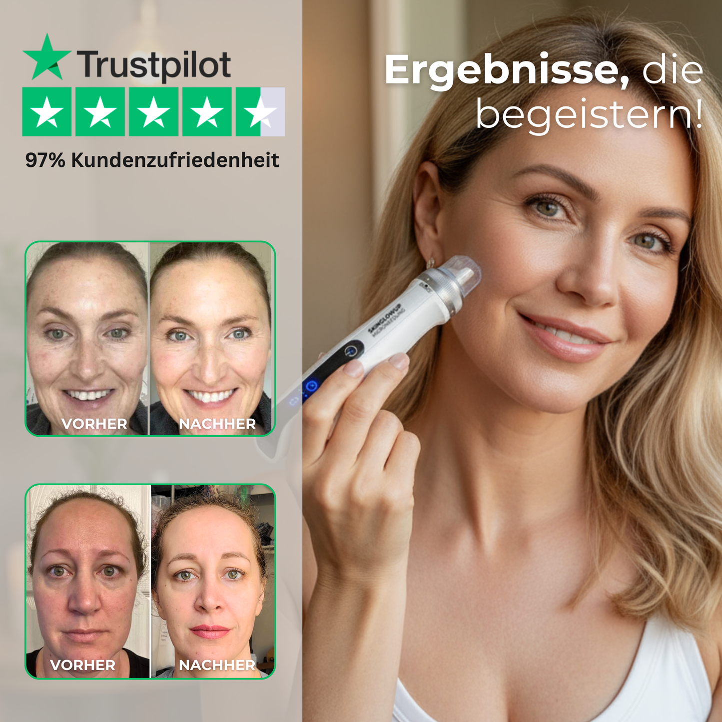 Dermapen Anti-Aging PRO 3in1 ᐅ Microneedling, EMS & LED