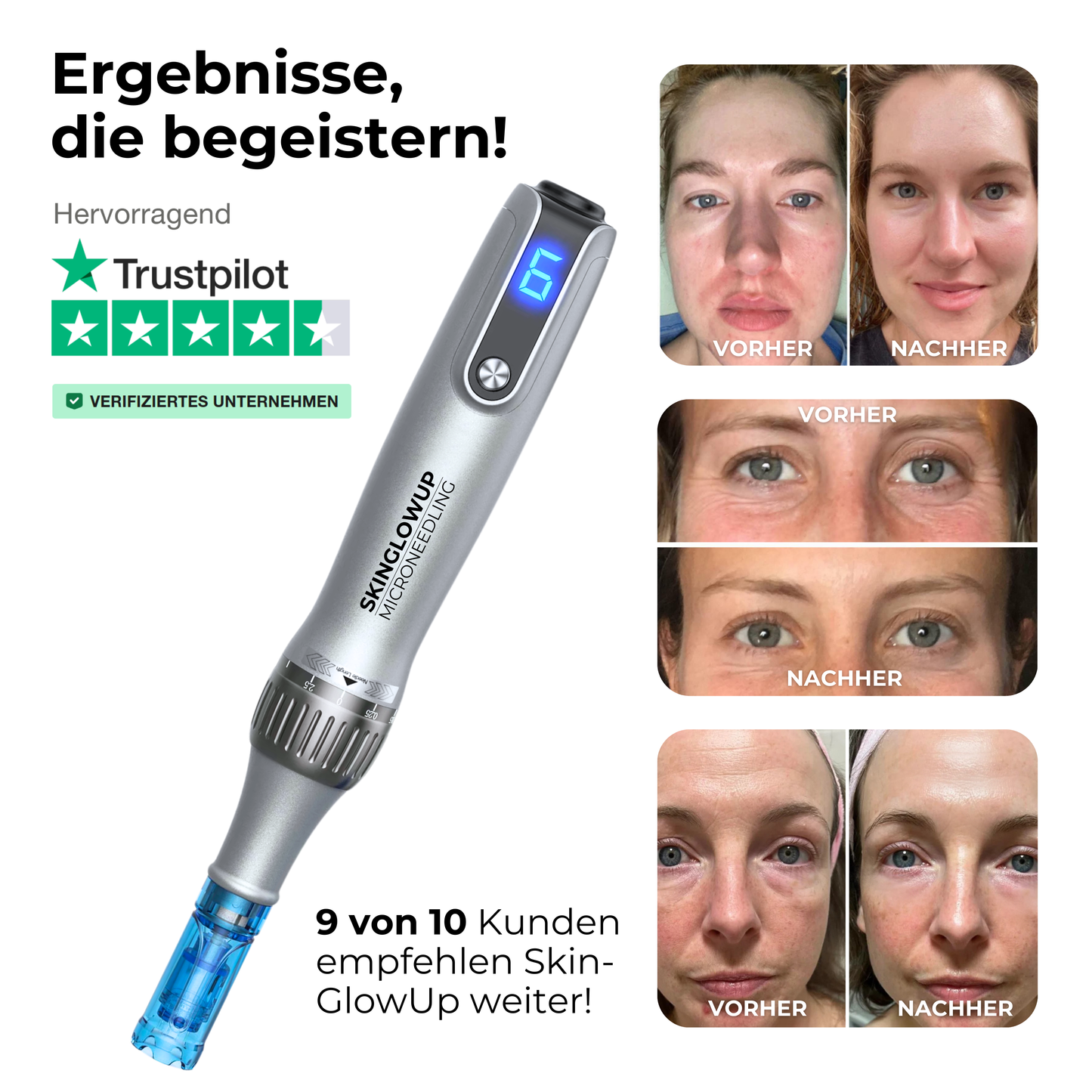 Dermapen Kollagen Boost PRO ᐅ Microneedling zuhause in Salonqualität