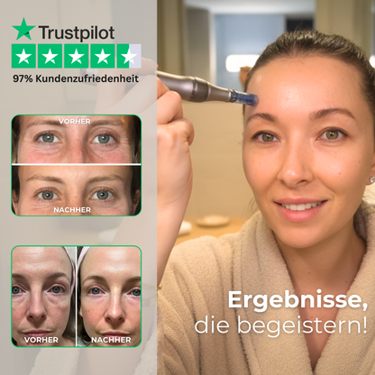 Dermapen Kollagen Boost PRO ᐅ Microneedling zuhause in Salonqualität