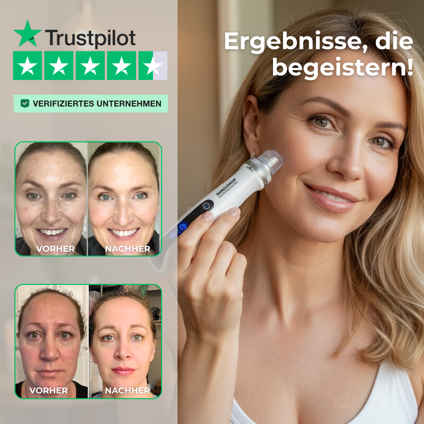 Dermapen Anti-Aging PRO 3in1 ᐅ Microneedling, EMS & LED für Studio Effekt zuhause