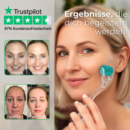 Dermaroller mit handgesteckten Nadeln im Set 0,2mm + 0,5mm ᐅ Für glatte Haut & feine Poren