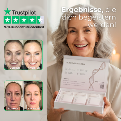 Micro Infusion System PRO mit Rose Exosome Serum ᐅ Intensive Hautverjüngung