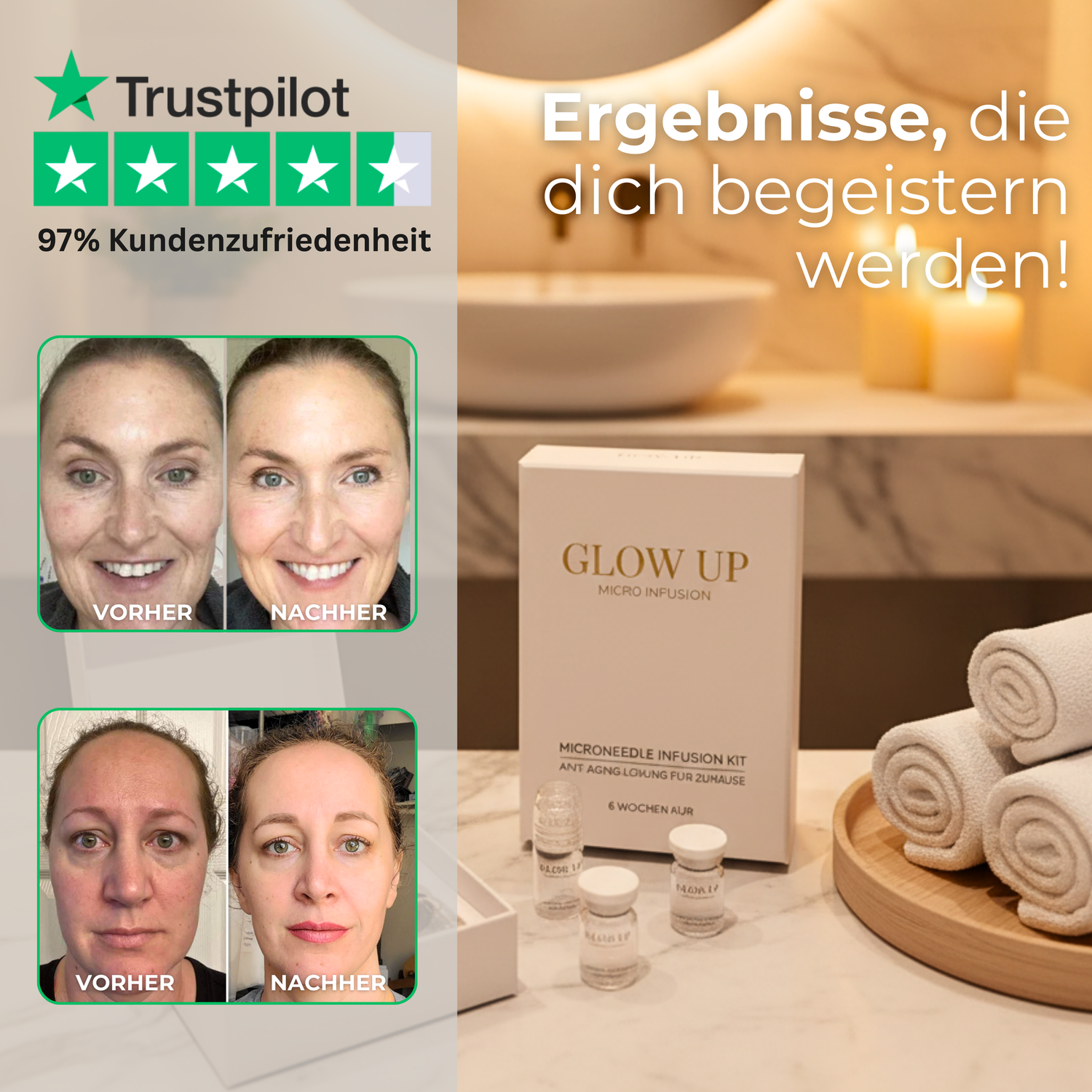 Micro Infusion Set Vorher-Nachher Ergebnisse gegen Falten – Glow Up Box mit Peptid Serum und Trustpilot Bewertung 97% Kundenzufriedenheit