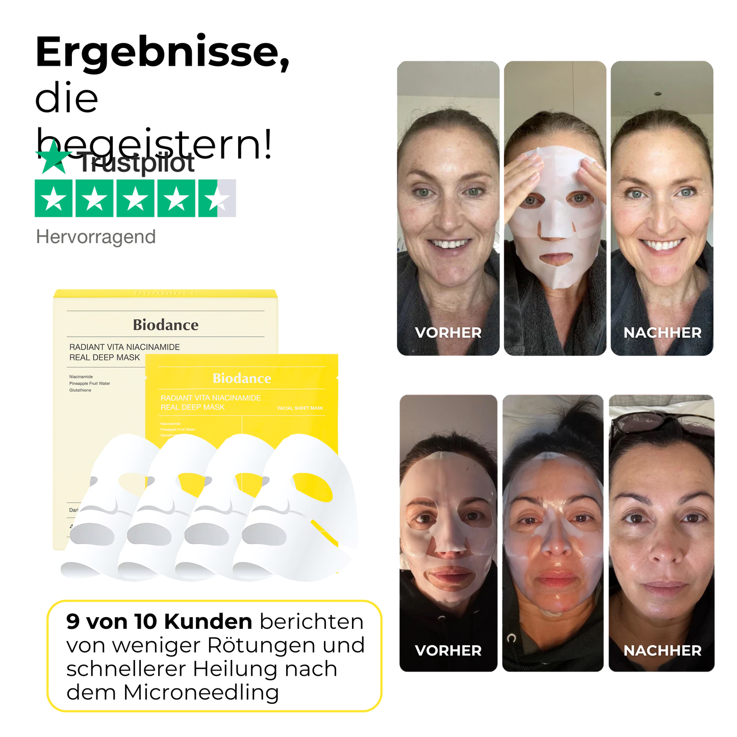 Beruhigende Niacinamide Maske nach Microneedling ᐅ Pflegt sanft & lindert Rötungen