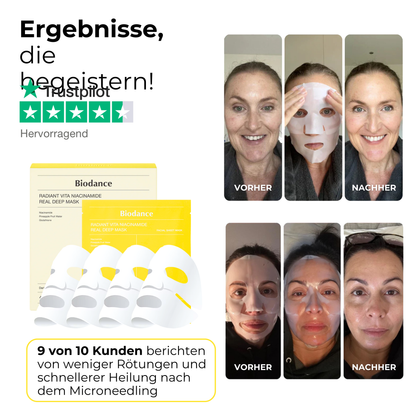 Beruhigende Niacinamide Maske nach Microneedling ᐅ Pflegt sanft & lindert Rötungen