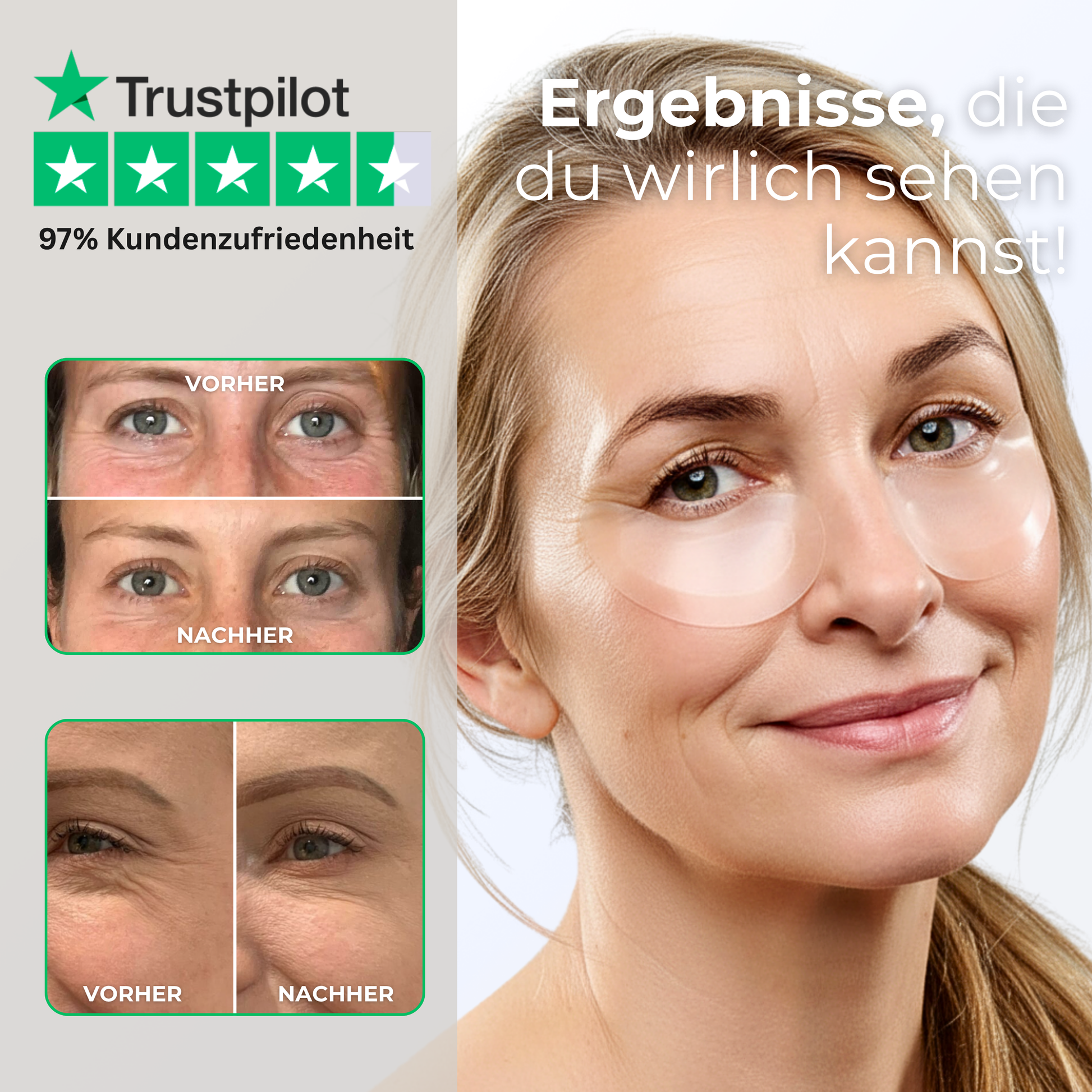 Microneedle Infusion Eye Patches Vorher-Nachher Effekt gegen Augenringe, Tränensäcke und feine Falten