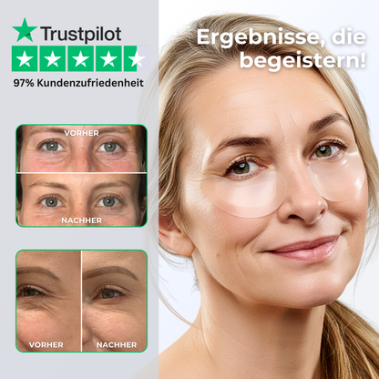 Microneedle Infusion Eye Patches Vorher-Nachher Effekt gegen Augenringe, Tränensäcke und feine Falten