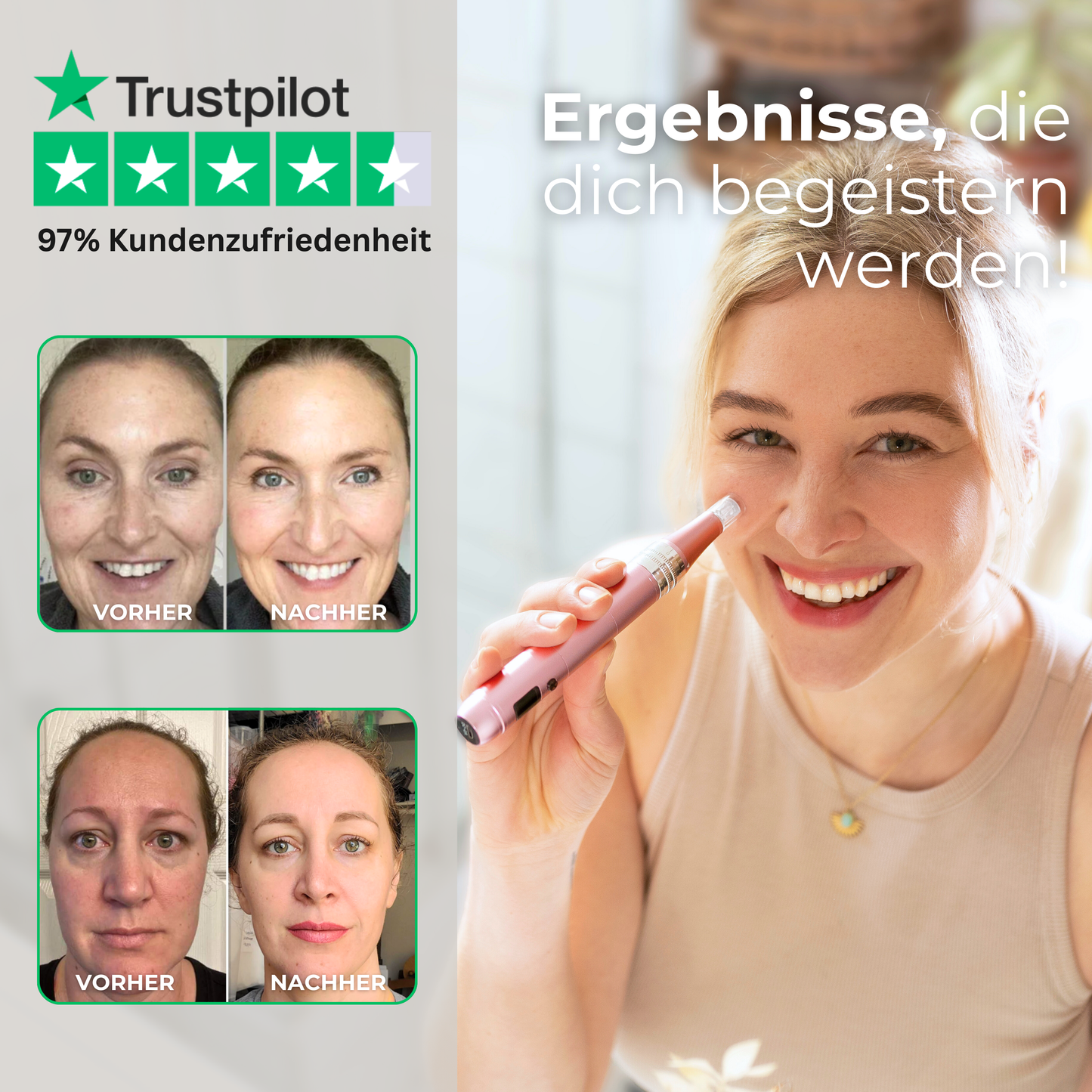 Anti-Aging Dermapen ᐅ Glatte Haut & weniger Falten zuhause