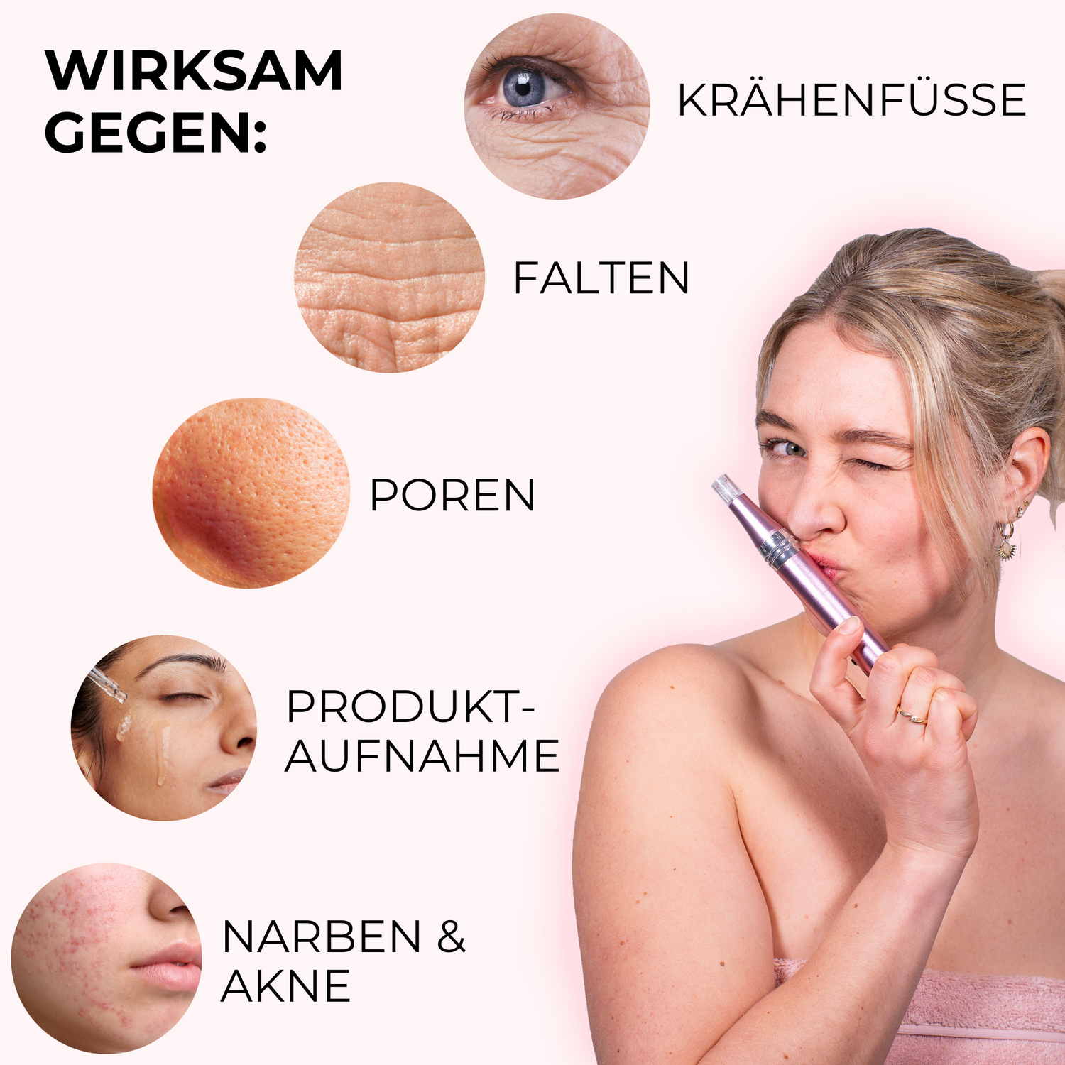 Behandlungsbereiche bei der Microneedling-Anwendung im Gesicht