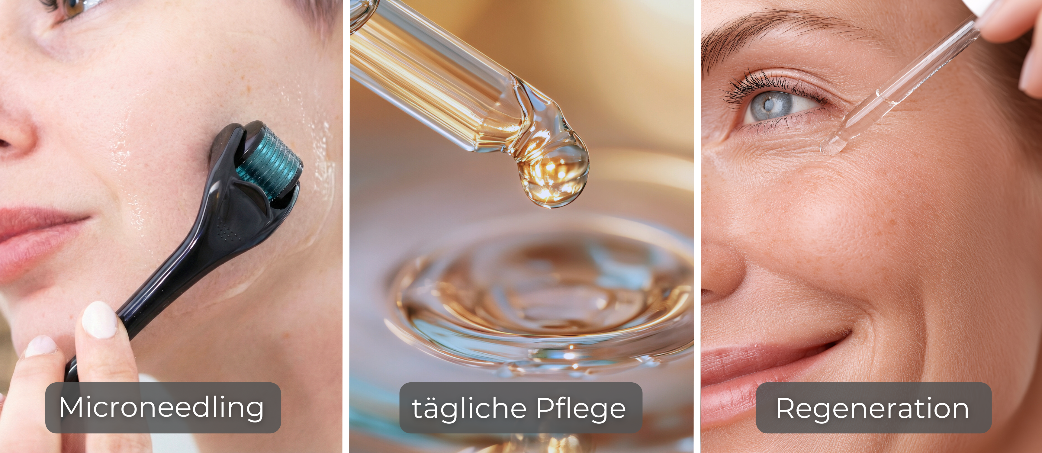 Frau verwendet Dermaroller mit Microneedling Serum im Gesicht, tägliche Pflege zur Regeneration der Haut