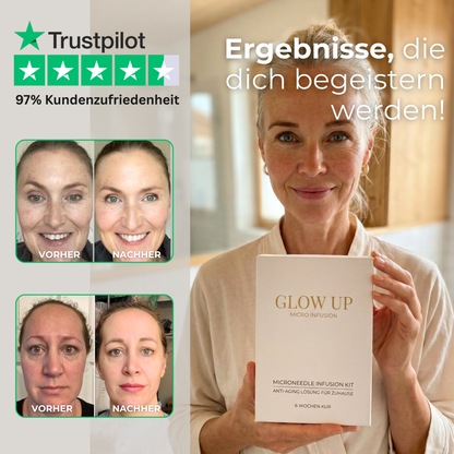 Micro Infusion Set Vorher-Nachher Ergebnisse gegen Falten – Glow Up Box mit Peptid Serum und Trustpilot Bewertung 97% Kundenzufriedenheit