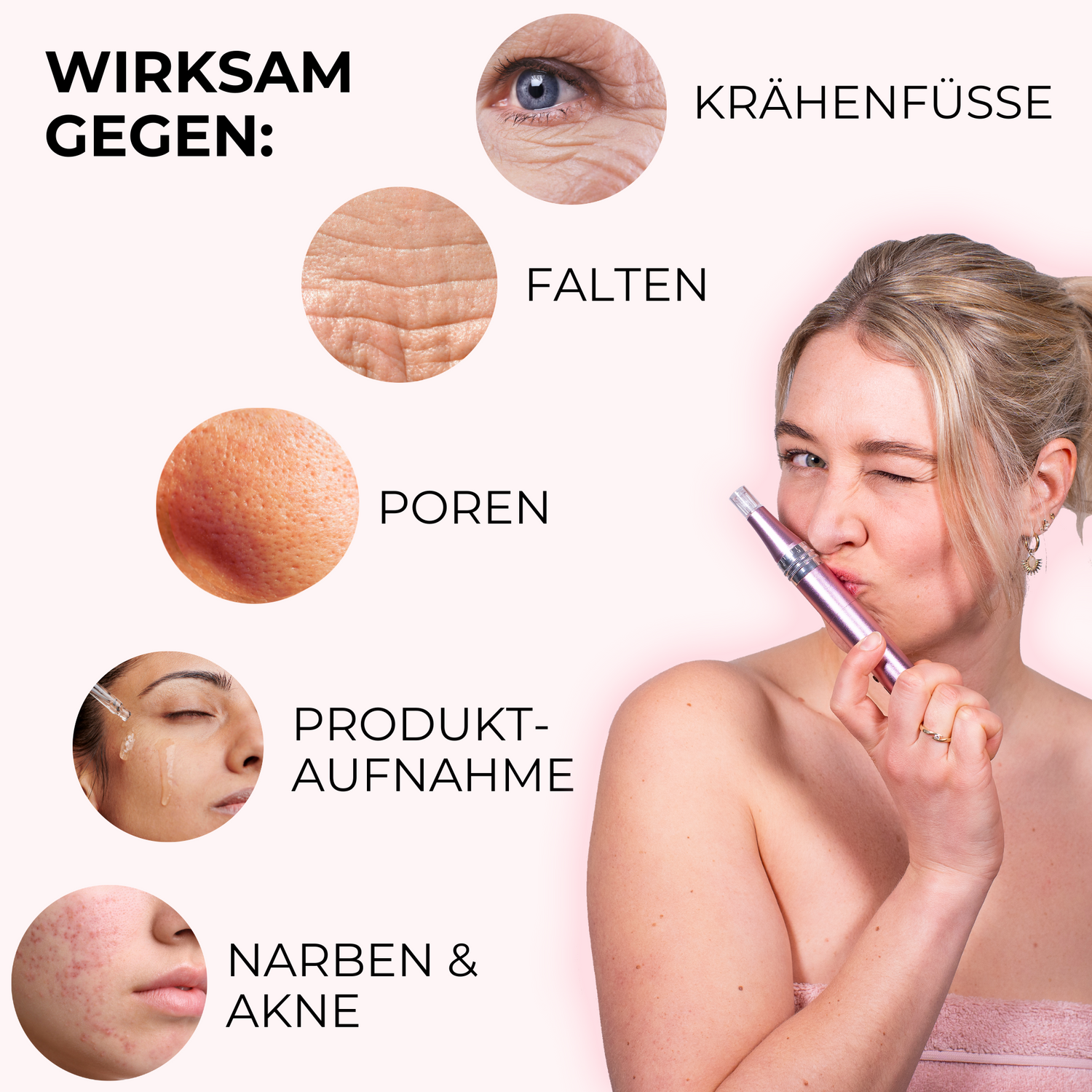 Eine Grafik die alle Behandlungsbereiche für Microneedling zuhause zeigt. Mit Microneedling selber machen können Krähenfüße, Falten, Poren, Narben und Akne Narben reduziert werden sowie die Aufnahme von Pflegeprodukten gesteigert werden.