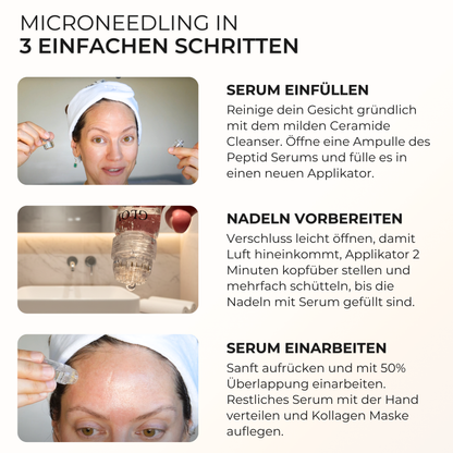 Microneedling zuhause Komplett Set ᐅ 6 Wochen Routine mit Reinigung, Anwendung & Pflege danach