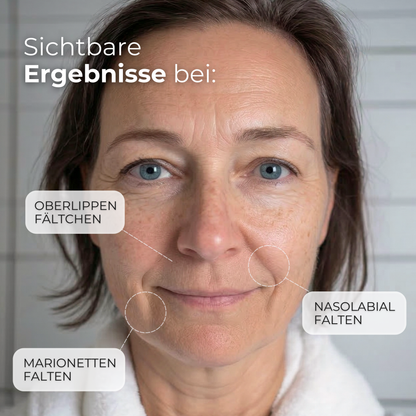 Hydrogel Patches für die Mundpartie gegen Nasolabialfalten, Marionettenfalten und Oberlippenfältchen