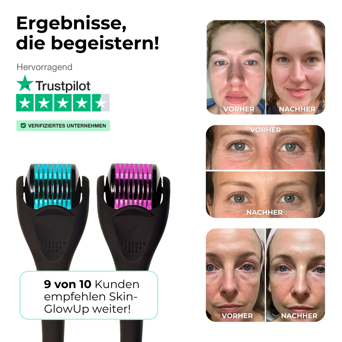 Dermaroller Set 0,2mm + 0,5mm ᐅ Feine Poren & Glatte Haut