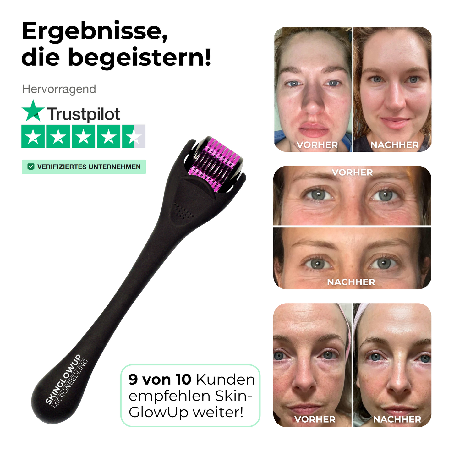 Microneedling Dermaroller Gesicht 0,2mm ᐅ Hautverjüngung & feine Poren